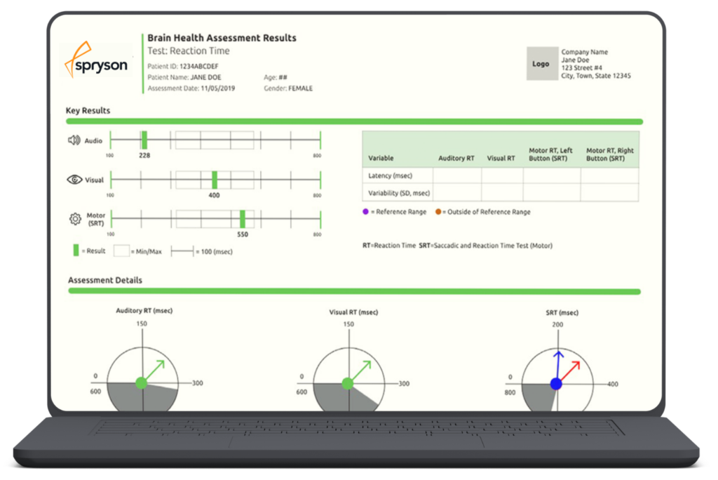 Sample Spryson eye-tracking results report compared with normative ranges
